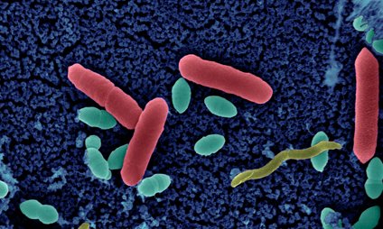 Projet SARA : surveillance de l’antibiorésistance en Afrique - Institut Pasteur